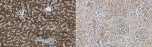 Anti-Acetyl CoA Carboxylase 1 Antibody, clone 10H2.1 