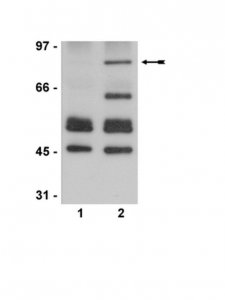Anti-acetyl-p53 Antibody (Lys373, Lys382) 