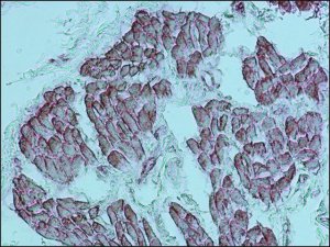 Anti-Actin (-Sarcomeric) antibody, Mouse monoclonal 