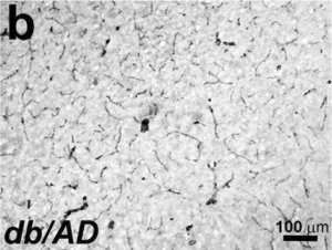 Anti-Actin, -Smooth Muscle antibody, Mouse monoclonal 