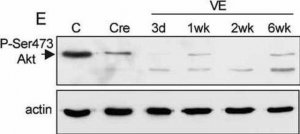 Anti-Actin, N-terminal antibody produced in rabbit 