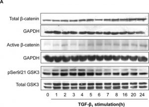 Anti-Active--Catenin (Anti-ABC) Antibody, clone 8E7 