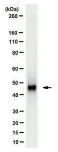 Anti-Adenosylhomocysteinase (AHCY) 