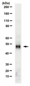 Anti-Adenosylhomocysteinase (AHCY) 