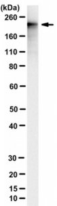 Anti-Adenylate Cyclase Toxin Antibody, B. pertussis Antibody, clone 9D4 