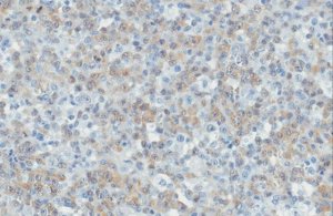 Anti-ALK Antibody, clone ALK1 
