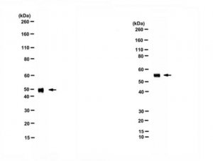 Anti-Alpha-2-HS-Glycoprotein 