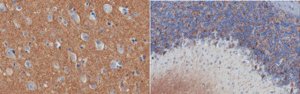 Anti-alpha-Synuclein 