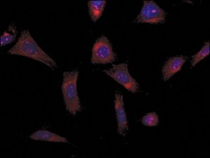 Anti-ALS2 (N-terminal region) antibody produced in rabbit 