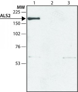 Anti-ALS2 (N-terminal region) antibody produced in rabbit 