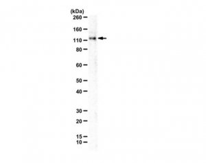 Anti-Anoctamin-1 (TMEM16A) 
