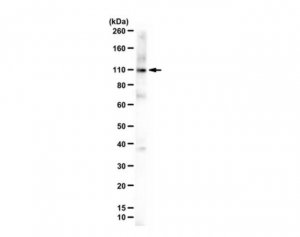 Anti-Anoctamin-1 (TMEM16A) 