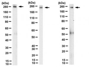 Anti-ApoB Antibody, clone 2G11 