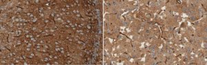 Anti-Aquaporin 4 