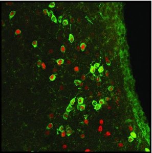Anti-ARP2 antibody, Mouse monoclonal 