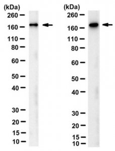 Anti-ASPP2 (TP53BP2) Antibody, clone DX54.10 