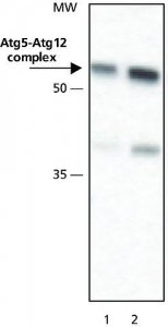 Anti-ATG5 (N-terminal) antibody produced in rabbit 