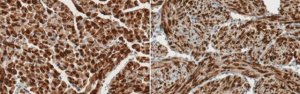 Anti-Atrial Natriuretic peptide 