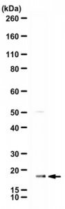Anti-Atrial Natriuretic peptide 
