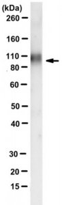 Anti-Autotaxin (ENPP2) Antibody, clone 7A5 
