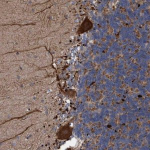 Anti-BBS9 antibody produced in rabbit 