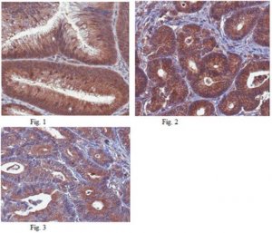 Anti-Beclin-1 Antibody, clone 9A1.1 