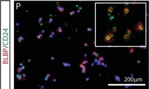 Anti-Brain lipid binding protein Antibody 