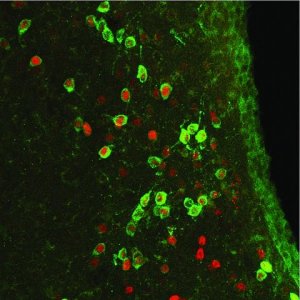 Anti-c-Fos antibody produced in rabbit 