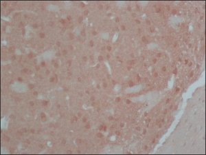 Anti-Calcineurin (-Subunit) antibody, Mouse monoclonal 