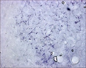 Anti-Calcitonin Gene Related Peptide antibody produced in rabbit 
