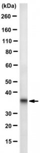 Anti-Calponin Antibody, clone CALP 