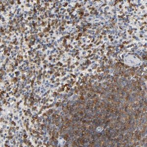 Anti-CAPN10 antibody produced in rabbit 