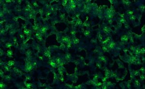 Anti-carboxypeptidase M Antibody, clone 7F9 