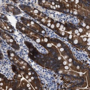 Anti-CBR1 antibody produced in rabbit 