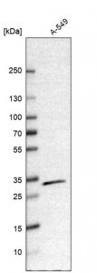 Anti-CBR1 antibody produced in rabbit 