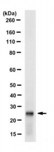 Anti-CBX1 (HP1 beta) Antibody, clone 5E9.1 