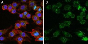 Anti-CD25 Antibody, clone 7D4 