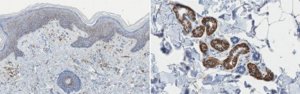 Anti-CD44 Antibody, clone Hermes-1 