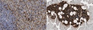 Anti-CD63 (LAMP3) Antibody, clone ME491 