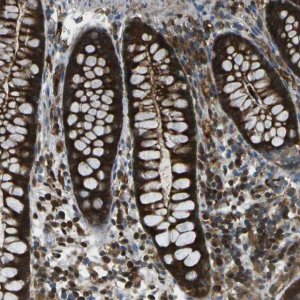 Anti-CDH23 antibody produced in rabbit 