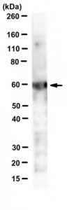 Anti-Chlamydial HSP60 Antibody, clone A57-B9 