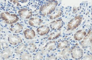 Anti-CLN6 Antibody, clone N400/24 