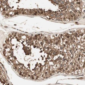 Anti-CNOT4 antibody produced in rabbit 