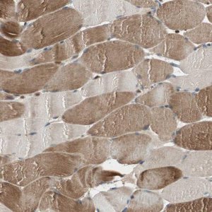 Anti-CNOT4 antibody produced in rabbit 