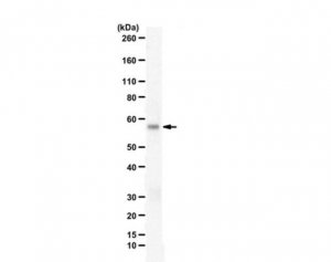 Anti-Coagulation factor VIIa 