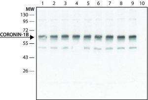 Anti-Coronin 1B antibody produced in rabbit 