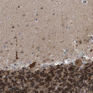 Anti-CRTC1 antibody produced in rabbit 