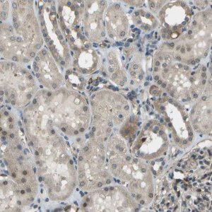 Anti-CTIF antibody produced in rabbit 
