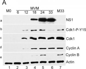 Anti-Cyclin B1 Antibody, clone GNS3 (8A5D12) 