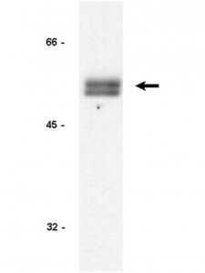 Anti-Cyclin E Antibody, clone HE12 